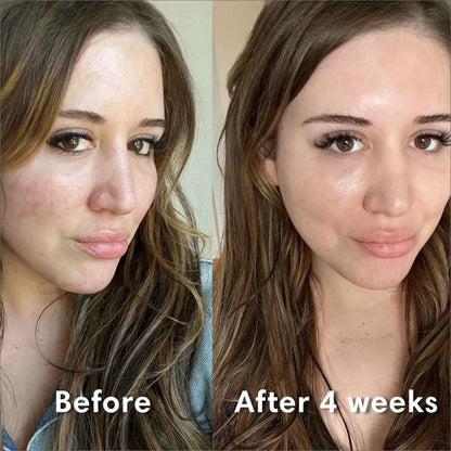 Luxury Collagen Glow Up Mask 2.0 (Spa-Level Results)